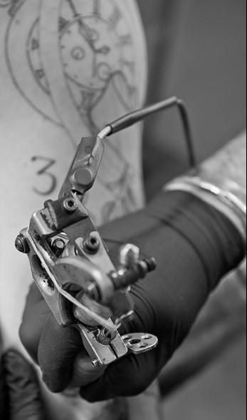 Verwijderen tattoo met laser Verwijderen tattoo met laser
